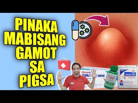 Antibiotic para sa pigsa sa pepe  BOIL By Dr Willie Ong 1